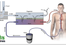 Understanding Extracorporeal Membrane Oxygenation (ECMO) Program Banner