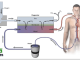 Understanding Extracorporeal Membrane Oxygenation (ECMO) Program Banner