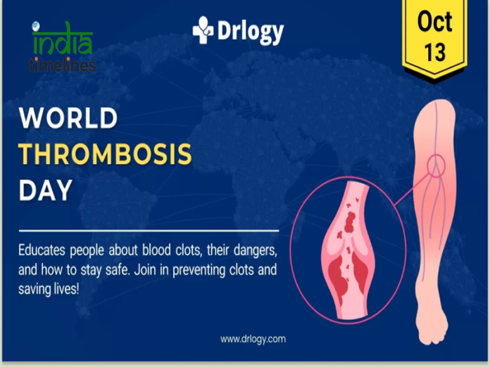 World Thrombosis Day 2024: Raising Awareness for Life-Saving Action